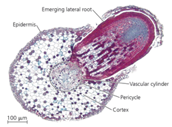  Lateral root